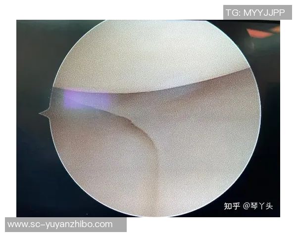 膝关节科医生：半月板的愈合能力极差，加维需延长术后休息时间